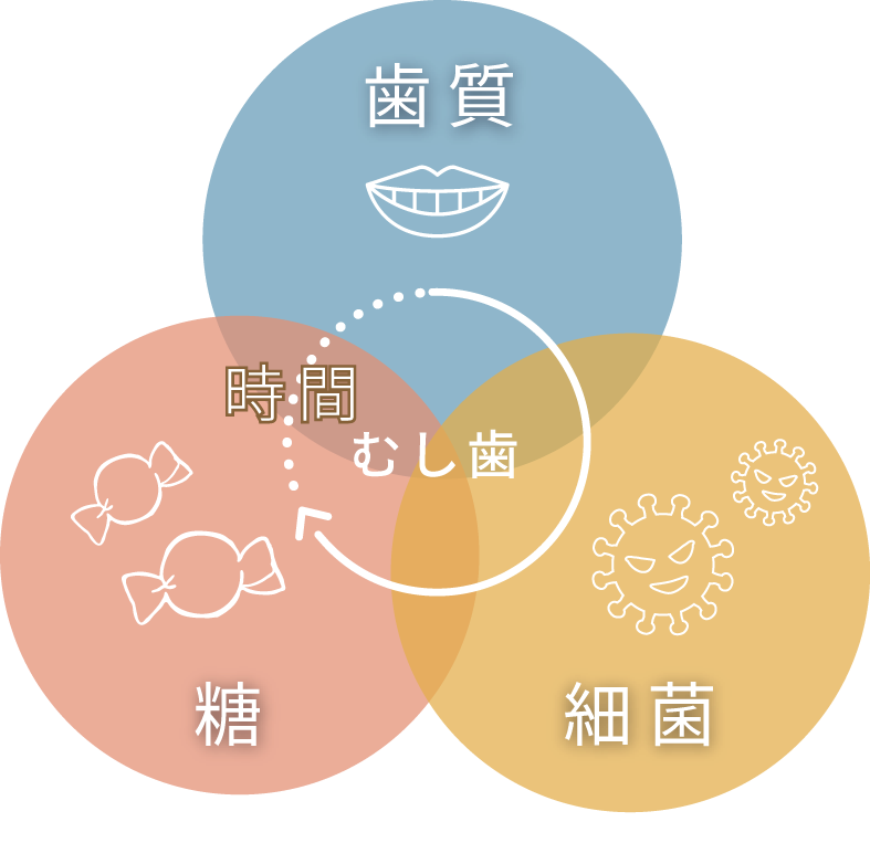 虫歯は歯質、細菌、糖に時間の経過が加わって発生する