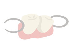 部分入れ歯